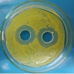 ỨNG DỤNG VI KHUẨN ĐỐI KHÁNG TRONG NUÔI TÔM 