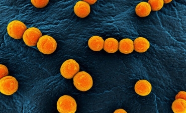 Vai trò của Enterococcus spp trong nuôi trồng thủy sản