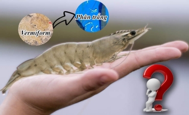 Vermiform và bệnh phân trắng