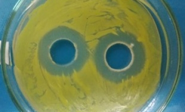 ỨNG DỤNG VI KHUẨN ĐỐI KHÁNG TRONG NUÔI TÔM 